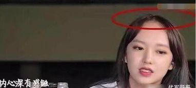 明星大爆料掉头发视频在线观看,掉发真相视频在线观看  第3张